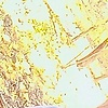 NORILETH