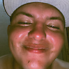 melvin_31190
