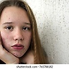 albeta_28067
