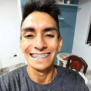 26-35