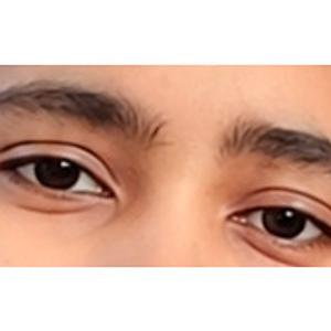 18-25