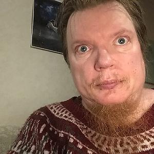 51+