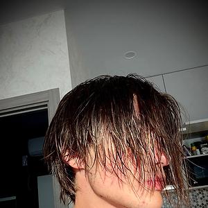 18-25