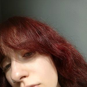 18-25