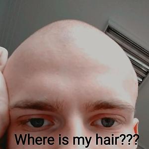 18-25