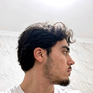 18-25