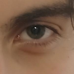 18-25