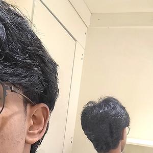 18-25