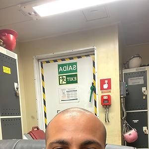 26-35