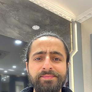 26-35