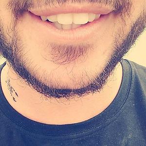 26-35