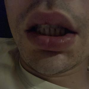 26-35