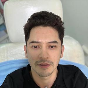 36-50