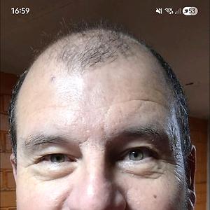 51+