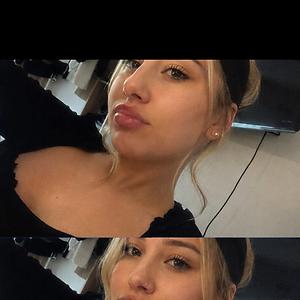 18-25