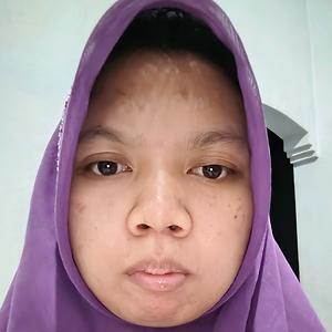 18-25