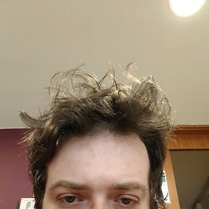 26-35