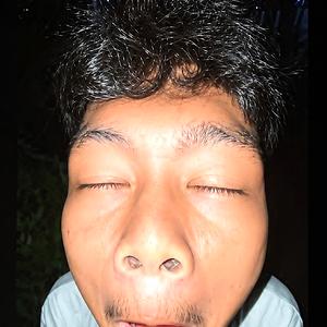 26-35