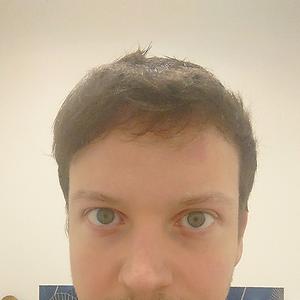 26-35