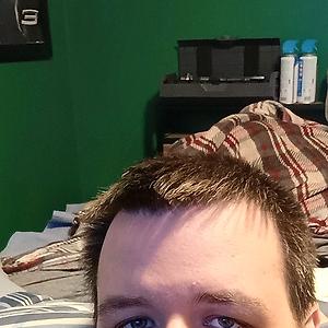 26-35