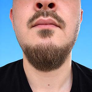 26-35