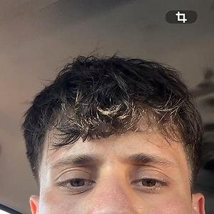 26-35