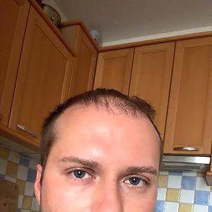 26-35