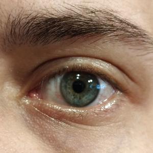 26-35