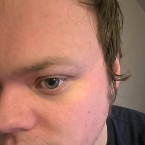 26-35