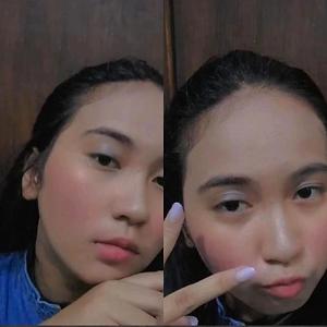 18-25
