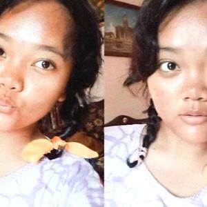 18-25