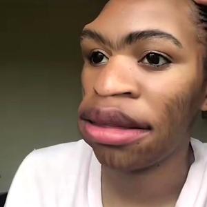 26-35