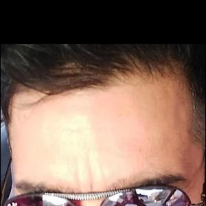 26-35