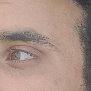 18-25