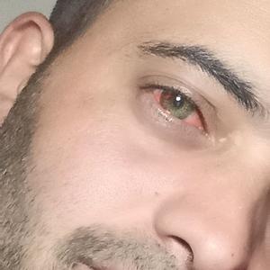 26-35
