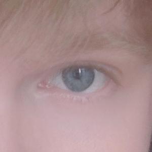 18-25