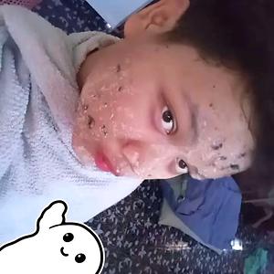 18-25